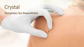  Presentation with clinic - Slide set with female patient in clinic cancer background and a cream colored foreground