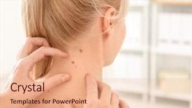  Presentation with skin cancer - PPT theme consisting of female patient in clinic cancer background and a coral colored foreground