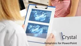  Presentation with baby ultrasound - Audience pleasing PPT layouts consisting of fetus - doctor showing baby ultrasound image backdrop and a light gray colored foreground