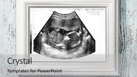  Presentation with ultrasound - Beautiful presentation featuring fetus - photo frame with ultrasound scan backdrop and a light gray colored foreground