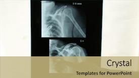  Presentation with review - Cool new slides with film review - doctor examins an x-ray backdrop and a coral colored foreground