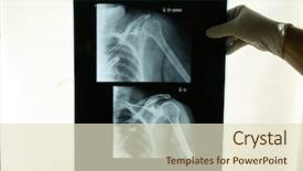  Presentation with doctor - Theme enhanced with film review - doctor examins an x-ray background and a soft green colored foreground