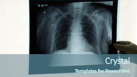  Presentation with review - Colorful slides enhanced with film review - doctor examins an x-ray backdrop and a ocean colored foreground