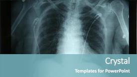  Presentation with chest - Slides enhanced with film review - real human chest x-ray background and a light blue colored foreground