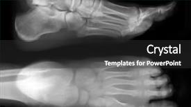  Presentation with film black and white - PPT layouts enhanced with fingers exposed on x-ray background and a dark gray colored foreground