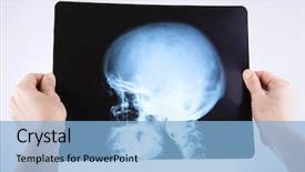 Presentation with head anatomy - Beautiful theme featuring foot ankle anatomy - doctor holding x-rays of head backdrop and a light blue colored foreground