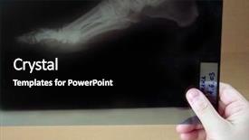  Presentation with microwave imaging image of modern - Beautiful presentation featuring foot x ray - man holding a image backdrop and a black colored foreground