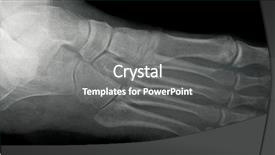  Presentation with foot ankle anatomy - Amazing slide deck having foot x-ray lateral view backdrop and a gray colored foreground