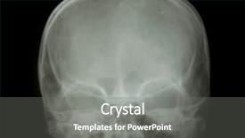  Presentation with x ray of a human - Presentation theme with front face skull x-ray background and a gray colored foreground