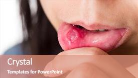  Presentation with fungal infection - Presentation theme with fungal infection - woman with aphthous stomatitis background and a coral colored foreground