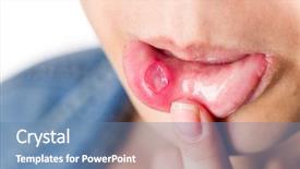  Presentation with fungal infection - Slides enhanced with fungal infection - woman with serious aphtha background and a teal colored foreground