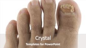  Presentation with fungi - PPT layouts enhanced with fungi nail isolated background and a coral colored foreground