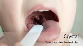  Presentation with asian doctor obese patient - Audience pleasing presentation theme consisting of garganta - little child patient at throat backdrop and a soft green colored foreground