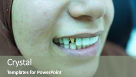  Presentation with fixed wing uav - Presentation design having gingiva - woman with bad teeth getting background and a gray colored foreground