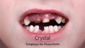  Presentation with gingival health - Presentation theme with gingival health - patient open mouth showing caries background and a coral colored foreground