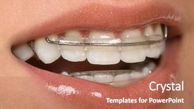  Presentation with dental - Presentation theme having girl with dental braces retainer background and a red colored foreground