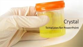  Presentation with specimen - Colorful PPT theme enhanced with gloved hand holding urine specimen backdrop and a lemonade colored foreground