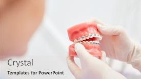  Presentation with malocclusion - Colorful PPT theme enhanced with gloves show a denture model with braces to correct a malocclusion backdrop and a lemonade colored foreground
