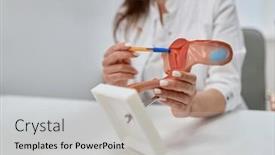  Presentation with gynecologist - Presentation having gynecologist-showing-structure-uterus-using background and a light gray colored foreground