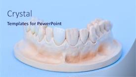  Presentation with jaw - Amazing slide set having gypsum-model-of-human-jaw backdrop and a light blue colored foreground