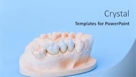  Presentation with jaw - PPT layouts having gypsum-model-of-human-jaw background and a light blue colored foreground
