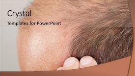  Presentation with hair loss - Slides enhanced with hair loss background and a coral colored foreground