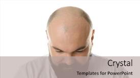  Presentation with bald - Cool new theme with hair trasplant - bald adult man on white backdrop and a light gray colored foreground