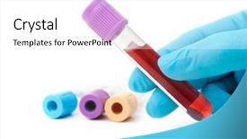  Presentation with testing blood - Slides having hand holding test tube background and a white colored foreground