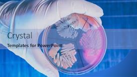  Presentation with coli - Slide deck with hand-in-glove-holding-petri background and a light blue colored foreground