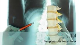  Presentation with spine - Slide deck with hands-in-gloves-with-model background and a light blue colored foreground