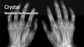  Presentation with film - Audience pleasing theme consisting of hands on x-ray film backdrop and a dark gray colored foreground