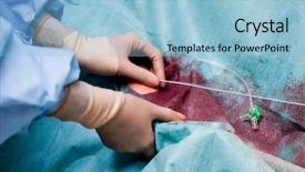  Presentation with catheter - Amazing presentation having hands with gloves placing catheter backdrop and a light blue colored foreground