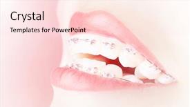  Presentation with dentistry - Amazing presentation design having happy smiling girl with braces backdrop and a lemonade colored foreground