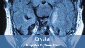  Presentation with human brain - Cool new slide deck with head-mrt-mr-image backdrop and a teal colored foreground