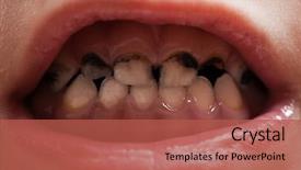  Presentation with gingival health - Beautiful slides featuring gingival health - dental medicine and healthcare backdrop and a red colored foreground