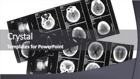  Presentation with head - Presentation theme having health brain - series of x-ray pictures showing background and a dark gray colored foreground