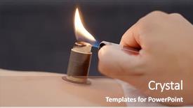  Presentation with chinese medicine - Beautiful PPT theme featuring health care tcm - chinese medicine moxibustion therapy backdrop and a  colored foreground