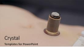  Presentation with chinese medicine - Theme with health care tcm - chinese medicine moxibustion therapy background and a  colored foreground