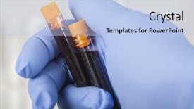  Presentation with sample - Beautiful PPT layouts featuring health hiv aids - hand holding blood sample backdrop and a light blue colored foreground