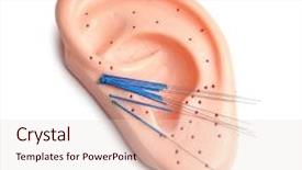  Presentation with human ear - Beautiful theme featuring health scheme - needles for acupuncture and plastic backdrop and a lemonade colored foreground