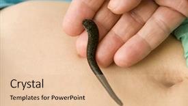  Presentation with health worm biology - Presentation theme with health worm biology - medicinal leech background and a lemonade colored foreground