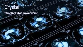  Presentation with chest - Colorful PPT theme enhanced with heart lungs - chest tomogram backdrop and a navy blue colored foreground