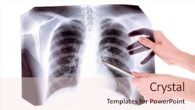  Presentation with chest - Amazing slides having heart lungs - x-ray image of chest isolated backdrop and a lemonade colored foreground