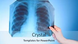  Presentation with chest - PPT theme featuring heart lungs - x-ray image of chest background and a light blue colored foreground
