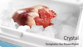  Presentation with fridge - Presentation theme featuring heart organ in fridge close background and a light gray colored foreground