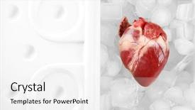  Presentation with fridge - Slides featuring heart organ in fridge close background and a white colored foreground