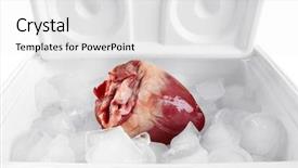  Presentation with organ transplant - Slide set consisting of heart organ in fridge close background and a white colored foreground