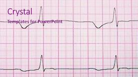  Presentation with ecg - Audience pleasing slide set consisting of heart pump - close-up of ecg graph backdrop and a lemonade colored foreground