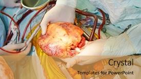  Presentation with hands heart - PPT layouts enhanced with heart transplantation human heart background and a yellow colored foreground