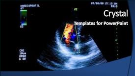  Presentation with medical heart - Amazing PPT layouts having heart ultrasound image on computer backdrop and a black colored foreground